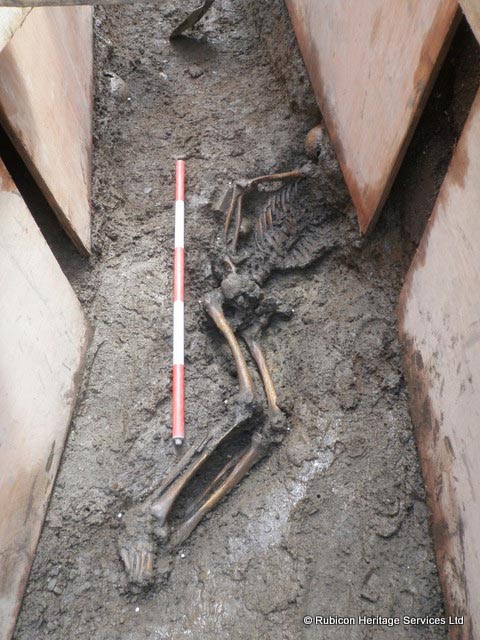 Medieval Human Remains Trinity College Dublin